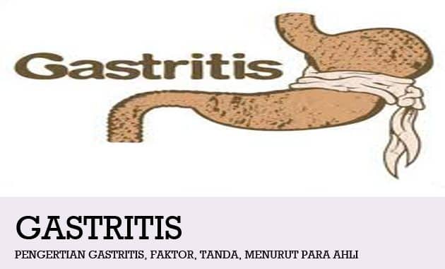 Pengertian Gastritis, Faktor, Tanda, Menurut Para Ahli